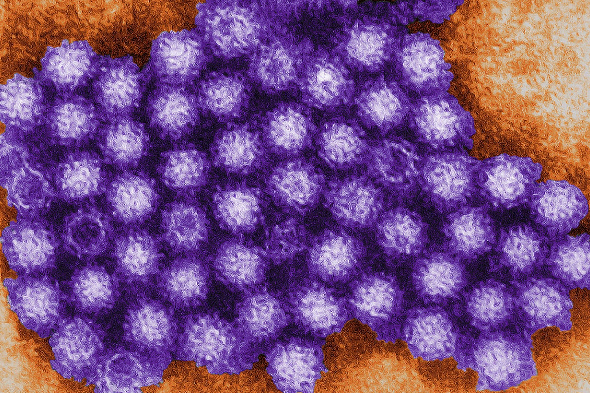 Qu'est-ce qu'un norovirus ?  L'UKHSA met en garde contre l'augmentation des cas