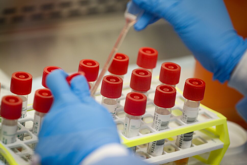 Nouvelles variantes COVID-19 donnant à XBB.1.16, ou «Arcturus», une course pour son argent |  Infos santé