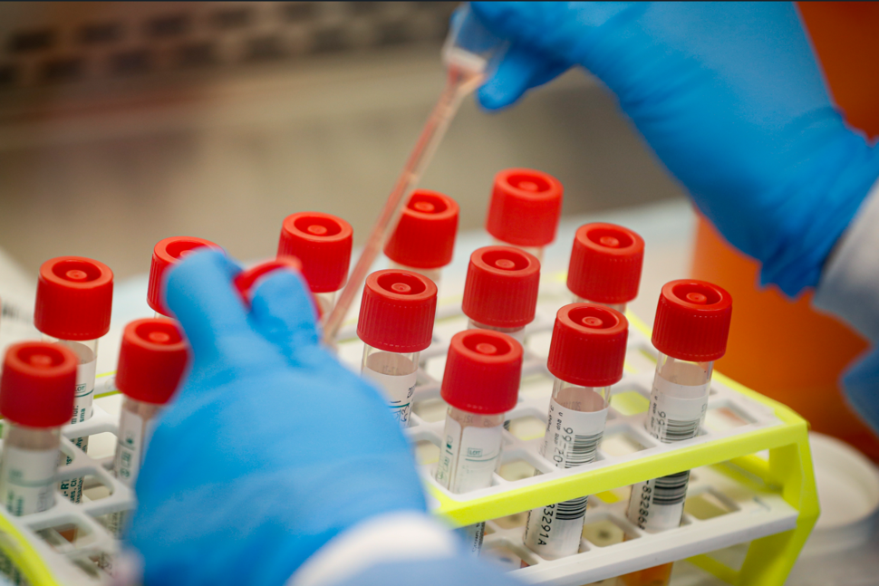 Ce qu'il faut savoir sur la dernière variante du COVID-19, HV.1 |  Infos santé