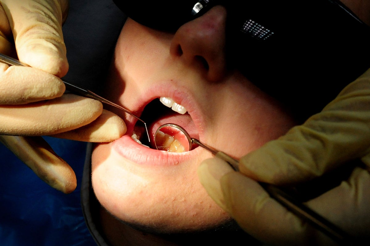 Les dentistes recevront « de l'argent pour les nouveaux patients » dans le cadre de plans visant à renforcer leurs services