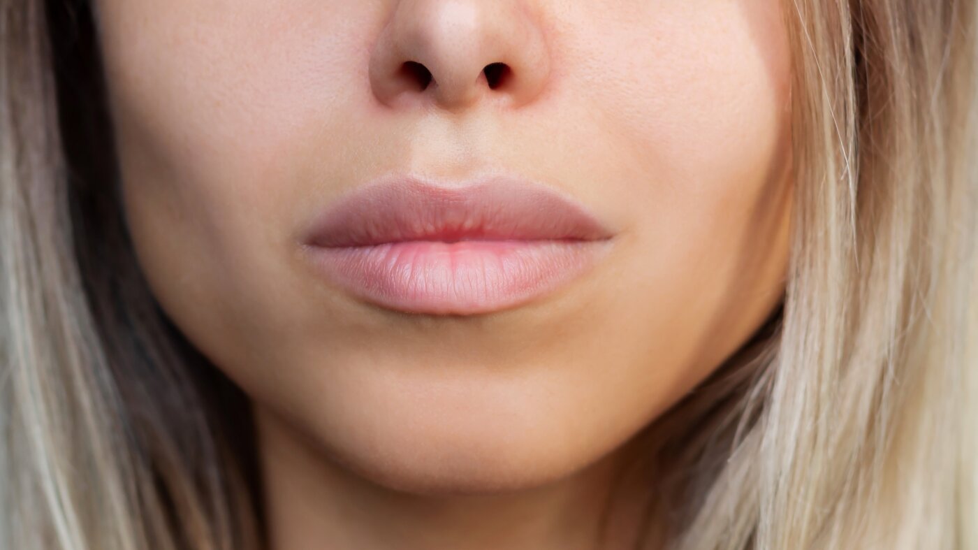 À la recherche du « visage Instagram », perdons-nous les imperfections qui nous rendent humains ?
